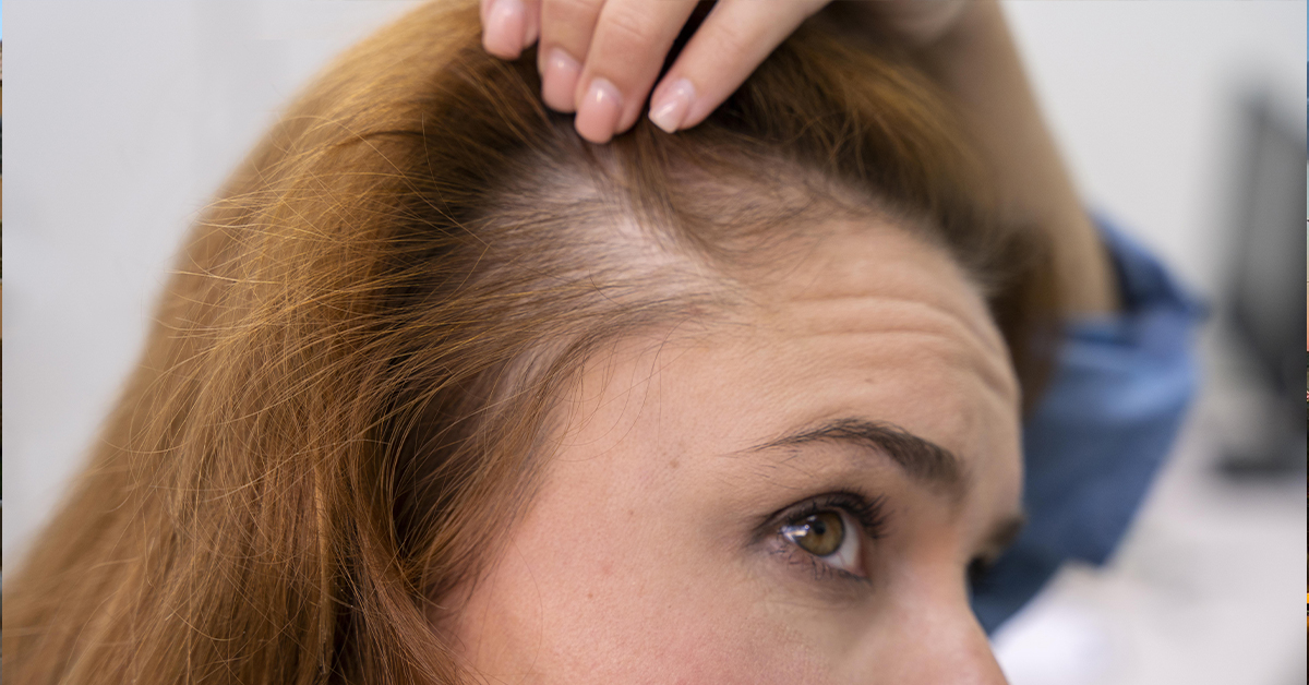 Caduta dei capelli: le cause principali e quando preoccuparsi
