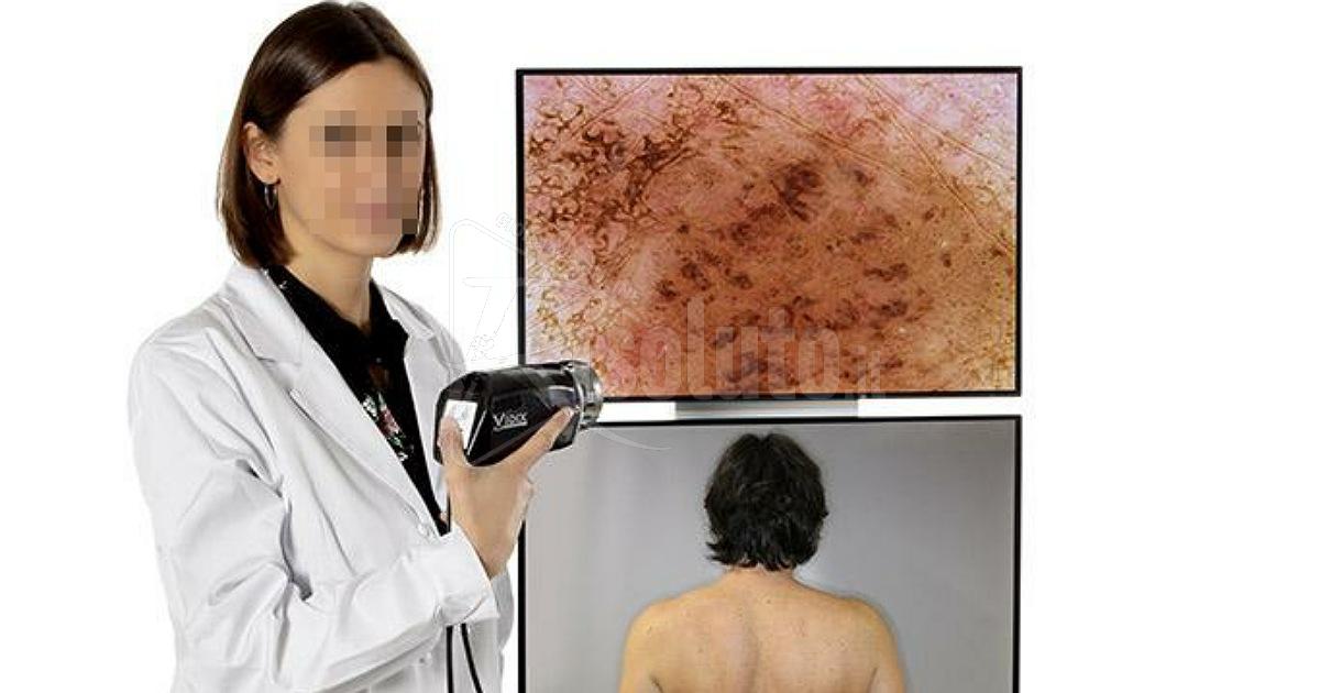 La Onlus Capurro dona al distretto sanitario un videodermatoscopio