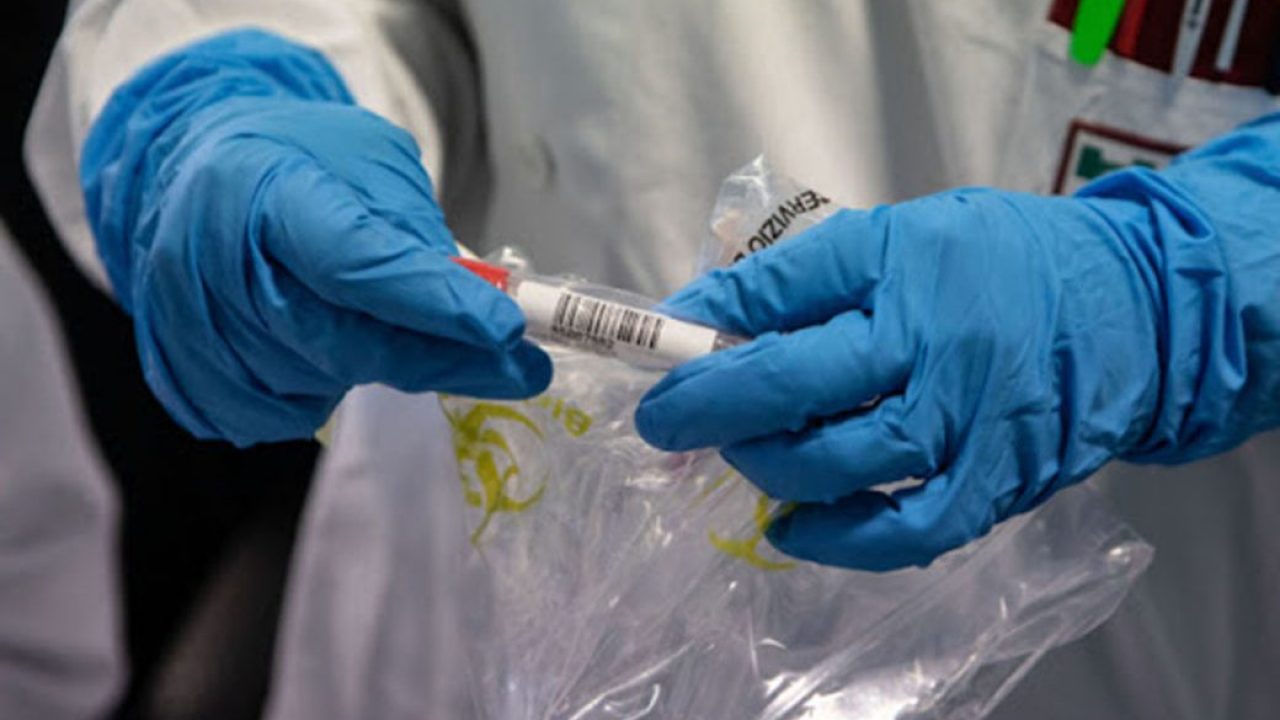 Altri 568 positivi al Coronavirus oggi in Sicilia, nessun decesso