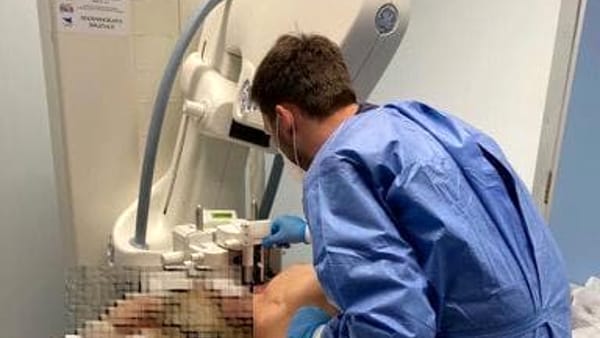 Diagnosi precoce del tumore al seno, ad Agrigento a giugno nuova apparecchiatura tecnologica