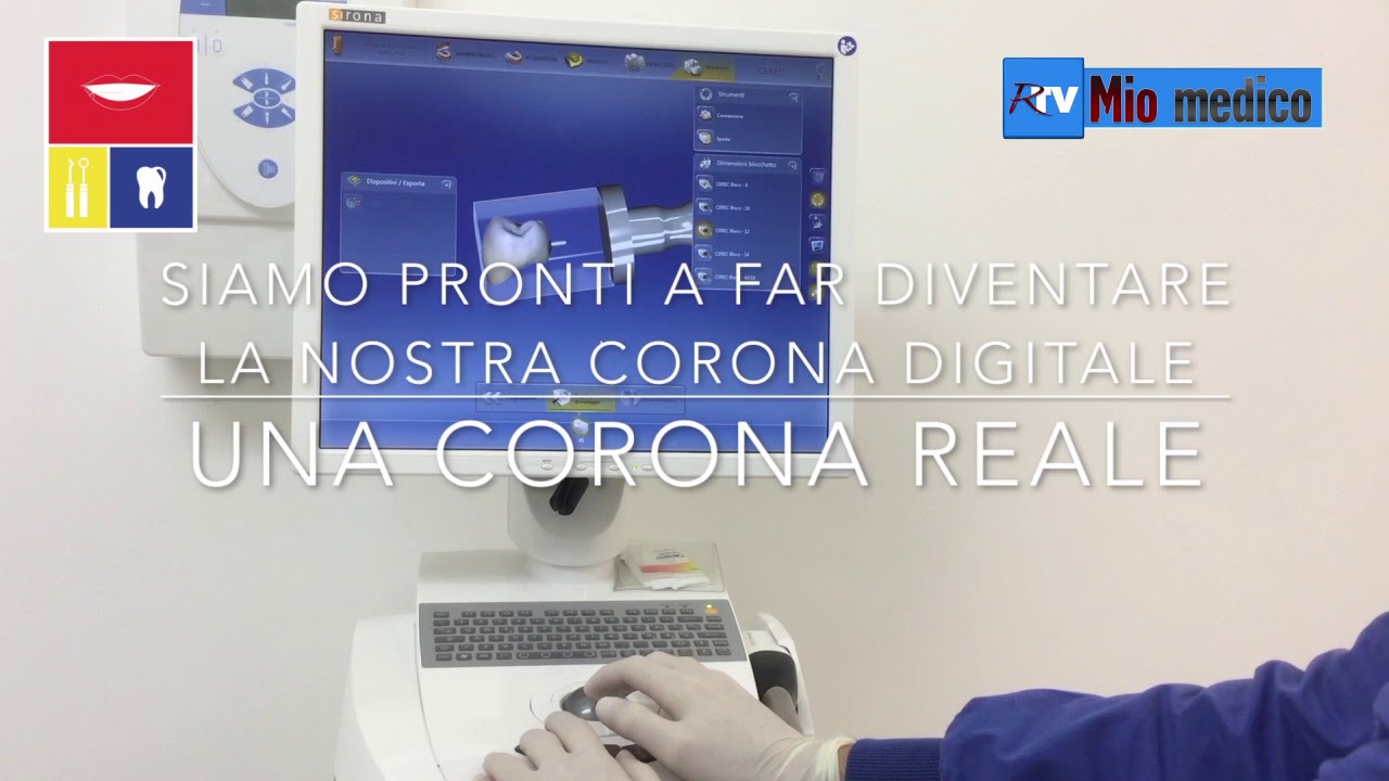 Addio invasive impronte, ora il restauro dentale si fa in una sola seduta