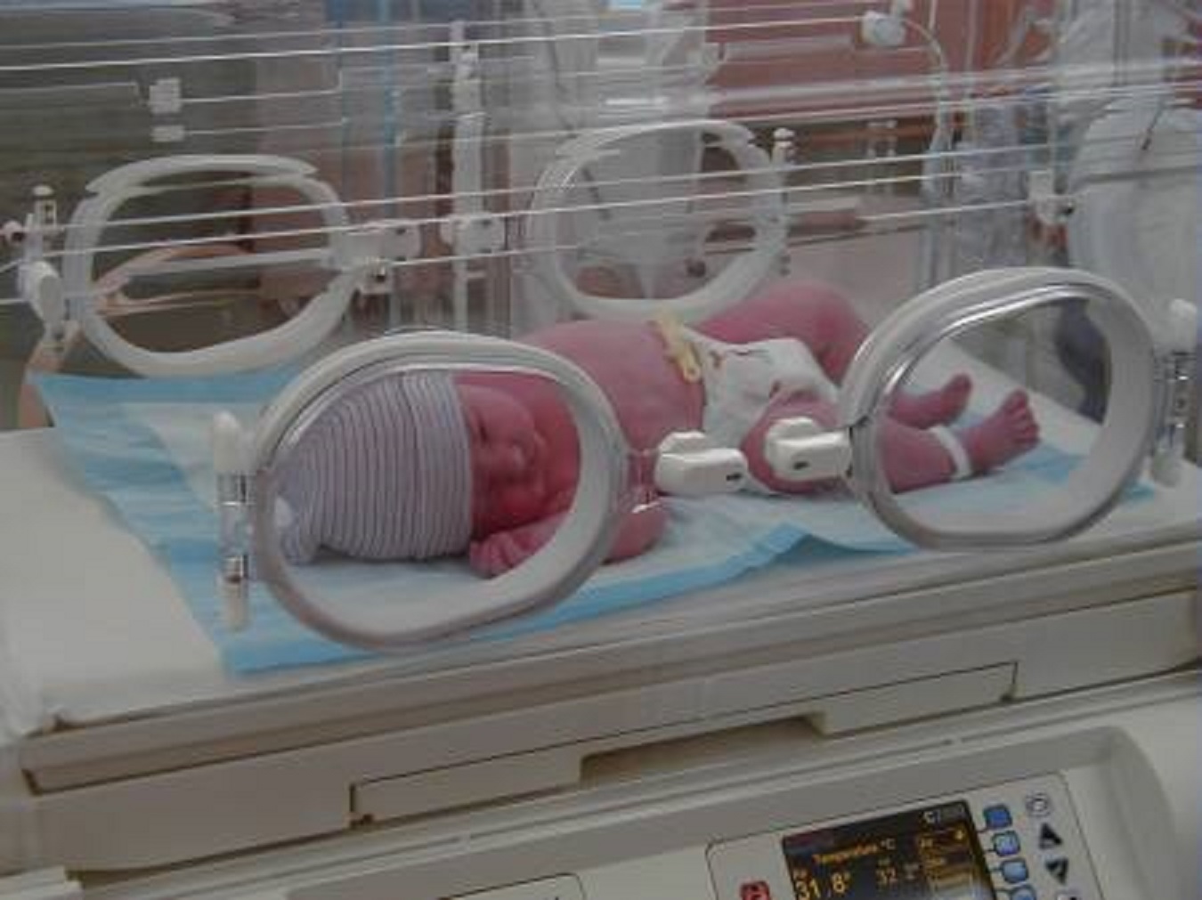 Incubatrice per la pediatria, l'associazione Capurro donera' il dispositivo al Giovanni Paolo II