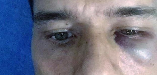Palermo: picchiato mentre fa jogging in via Maqueda