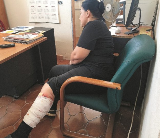 Donna aggredita da un cane a Castelvetrano, 76 punti di sutura alla gamba