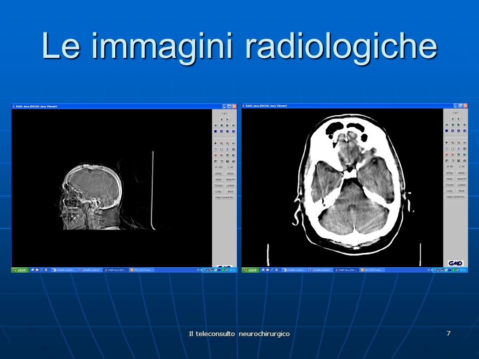 Da maggio il servizio di "teletac", già attivo a Sciacca e Agrigento, sarà operativo anche negli ospedali di Licata Canicattì e Ribera