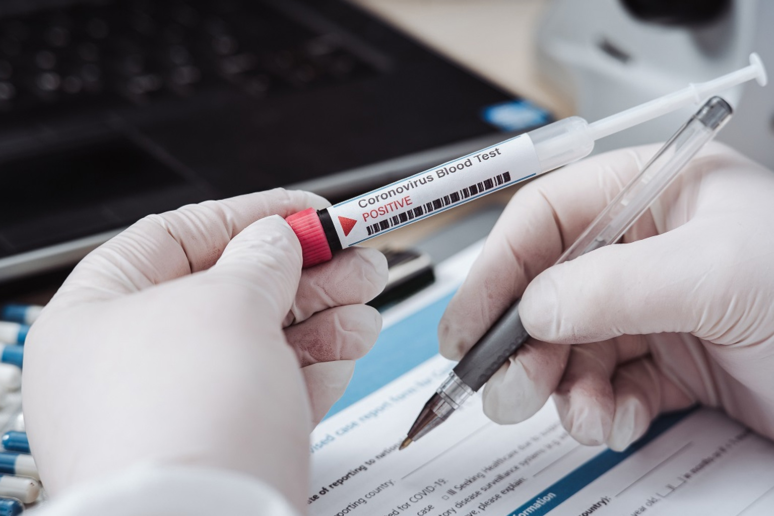 Arriva la circolare che da il via ai test sierologici in Sicilia, i cittadini potranno sottoporsi al controllo nei laboratori accreditati