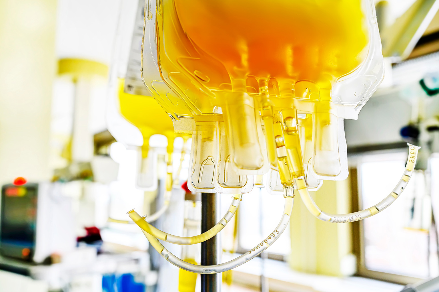 Plasma iperimmune utilizzato su un paziente di Partinico, è la prima volta nella Sicilia occidentale