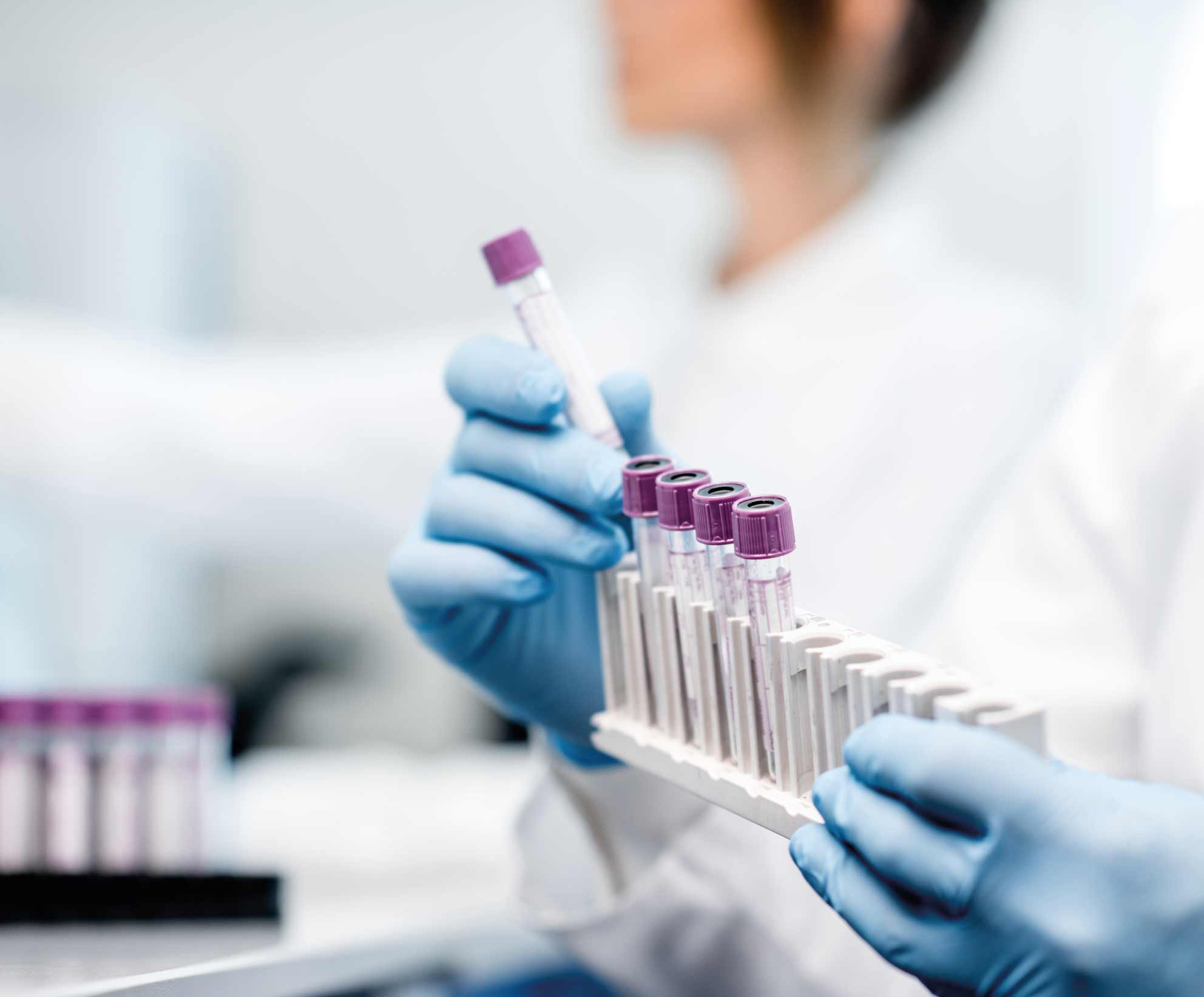 Accolto il ricorso di tre laboratori agrigentini, illegittima la procedura di recupero delle differenze tariffarie da parte dell'Asp