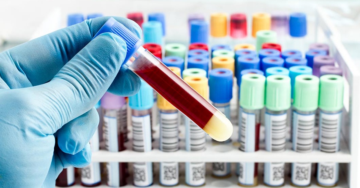 Accreditamento dei laboratori, il Tar Palermo bacchetta l’Assessorato alla Salute: obbligo di decidere sulla rete Krealab