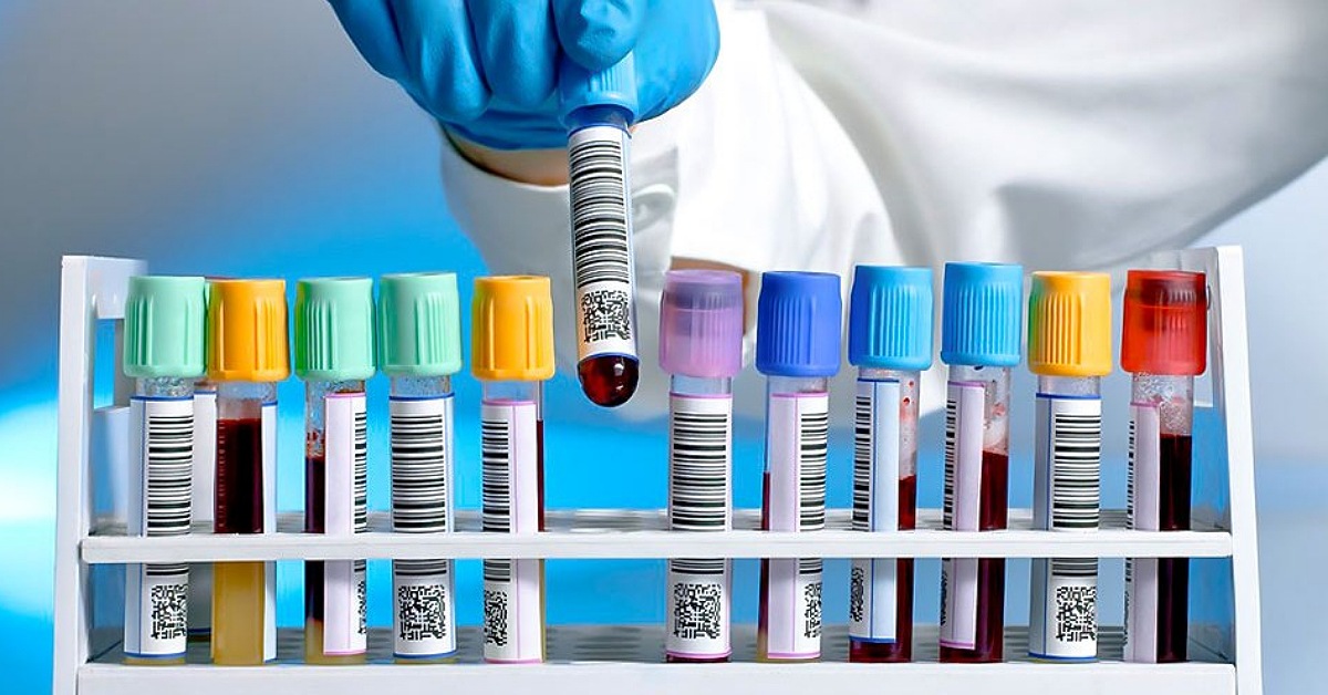 Sciopero dei laboratori di analisi, serrata totale oggi a Sciacca, Ribera e Menfi